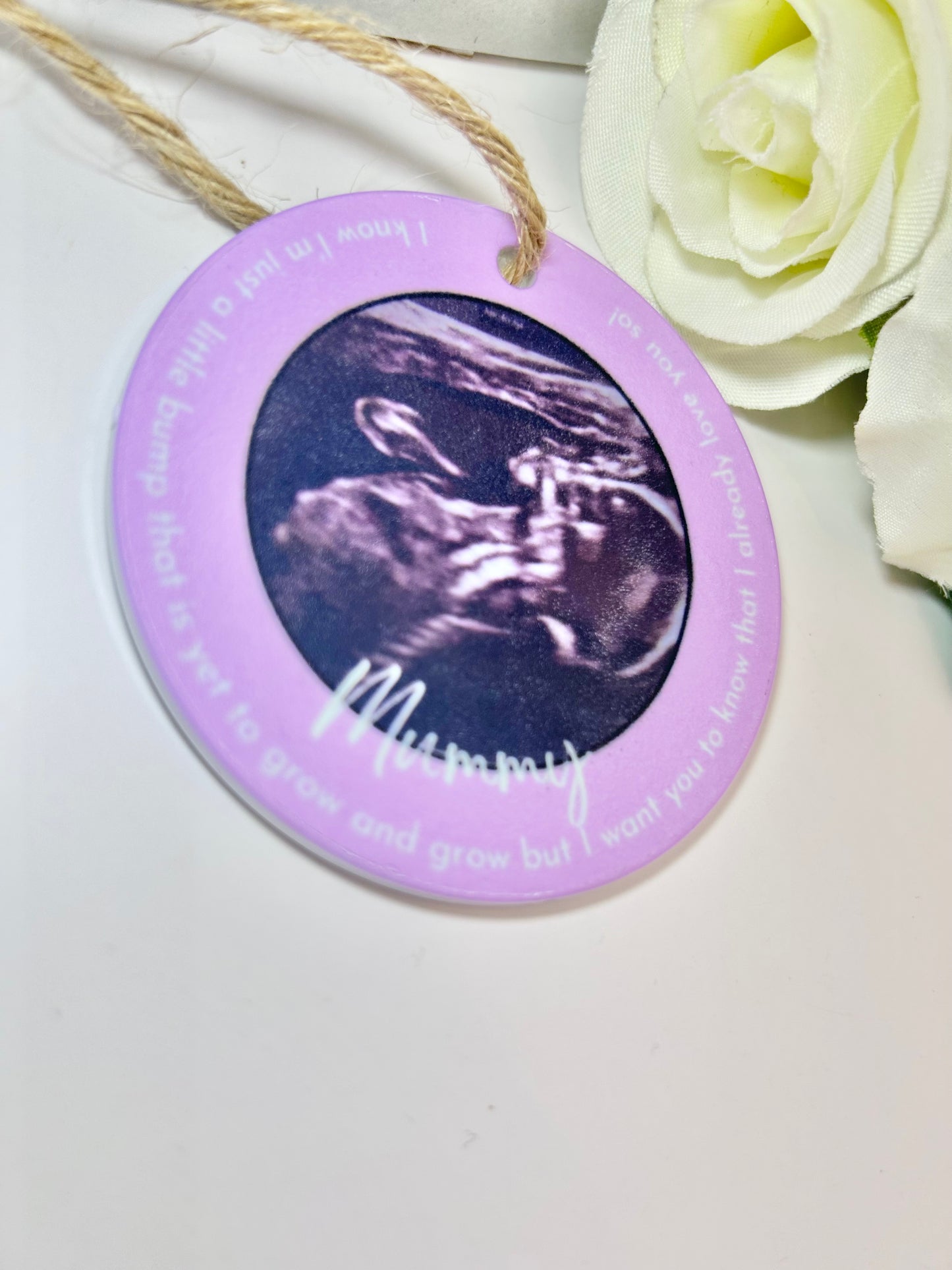 Baby Scan Tree Ornaments